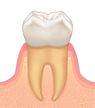 健康な歯茎の状態